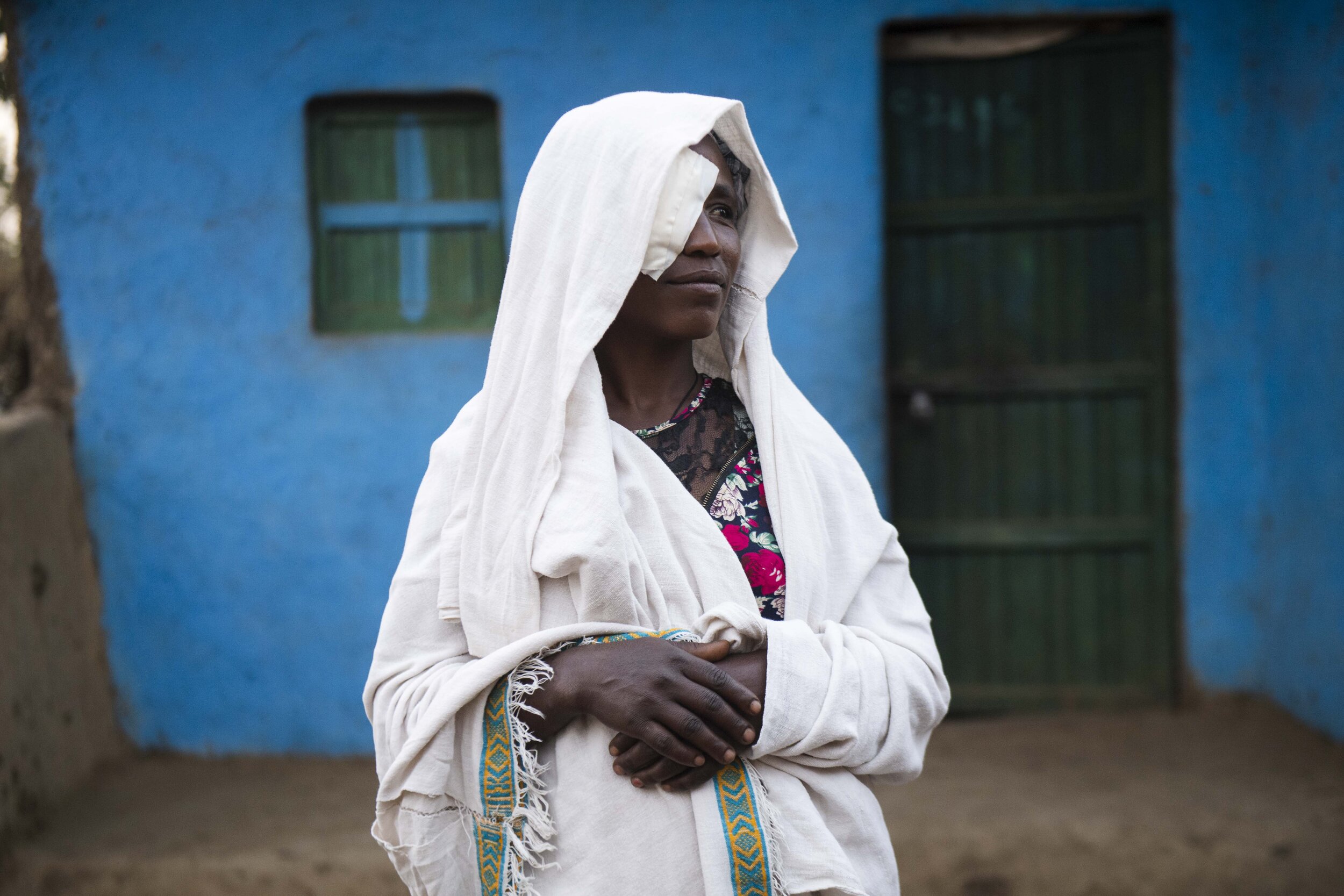  Asnaku stands outside her home after receiving corrective eye surgery for Trachomatous Trichiasis (TT) 