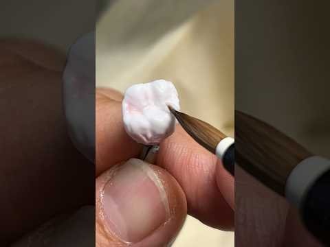 PFM Build-Up and Contouring