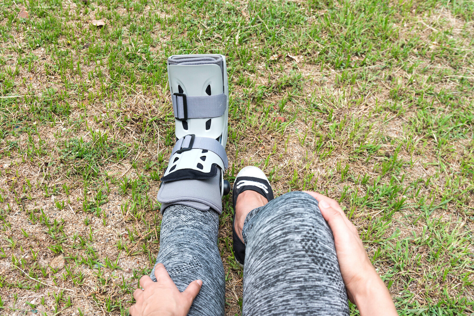 Bunion Surgery Recovery: What To Expect 