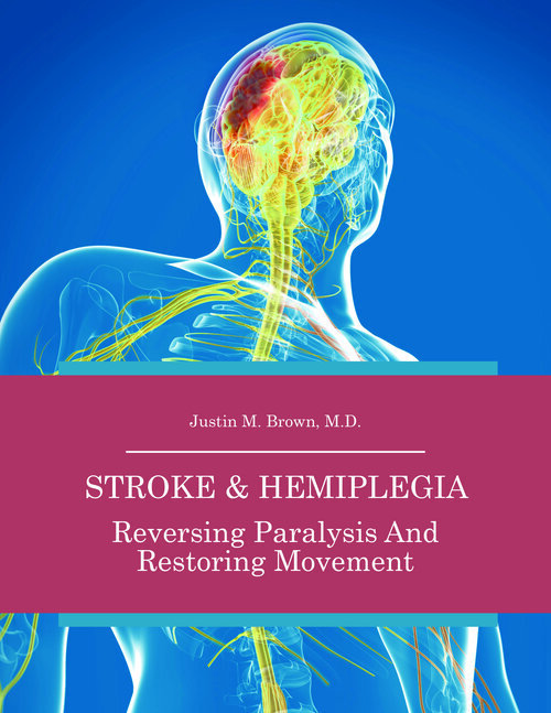 Stroke &amp; Hemiplegia Treatment