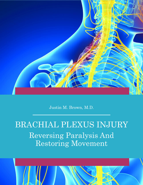 Brachial Plexus Treatment