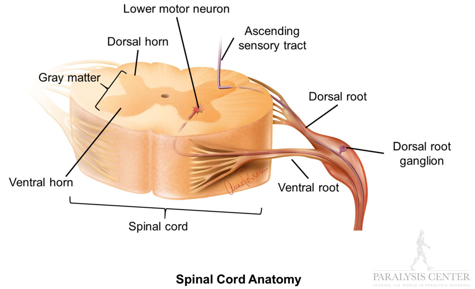 Spinal Cord Injury — Paralysis Center