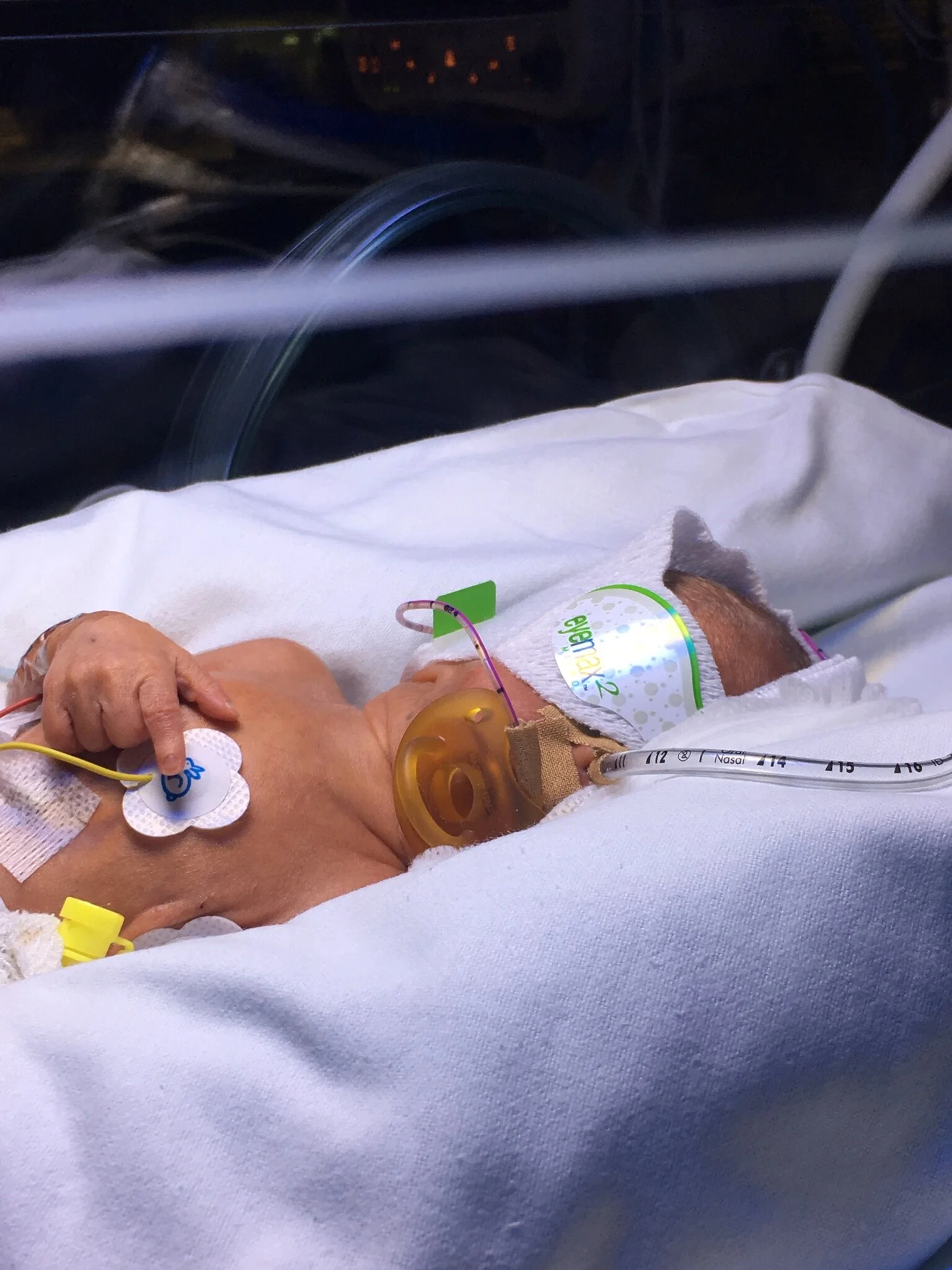 Three NICUs, two countries and one air ambulance: Arthur’s journey