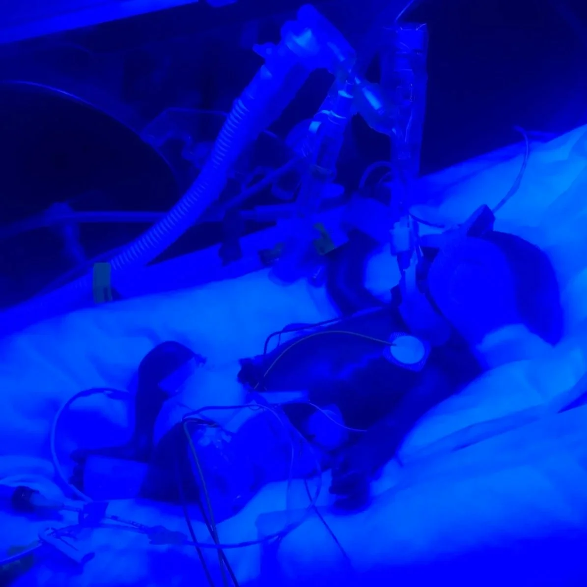 'This is NICU' filmstar: Max (24+5 weeks)