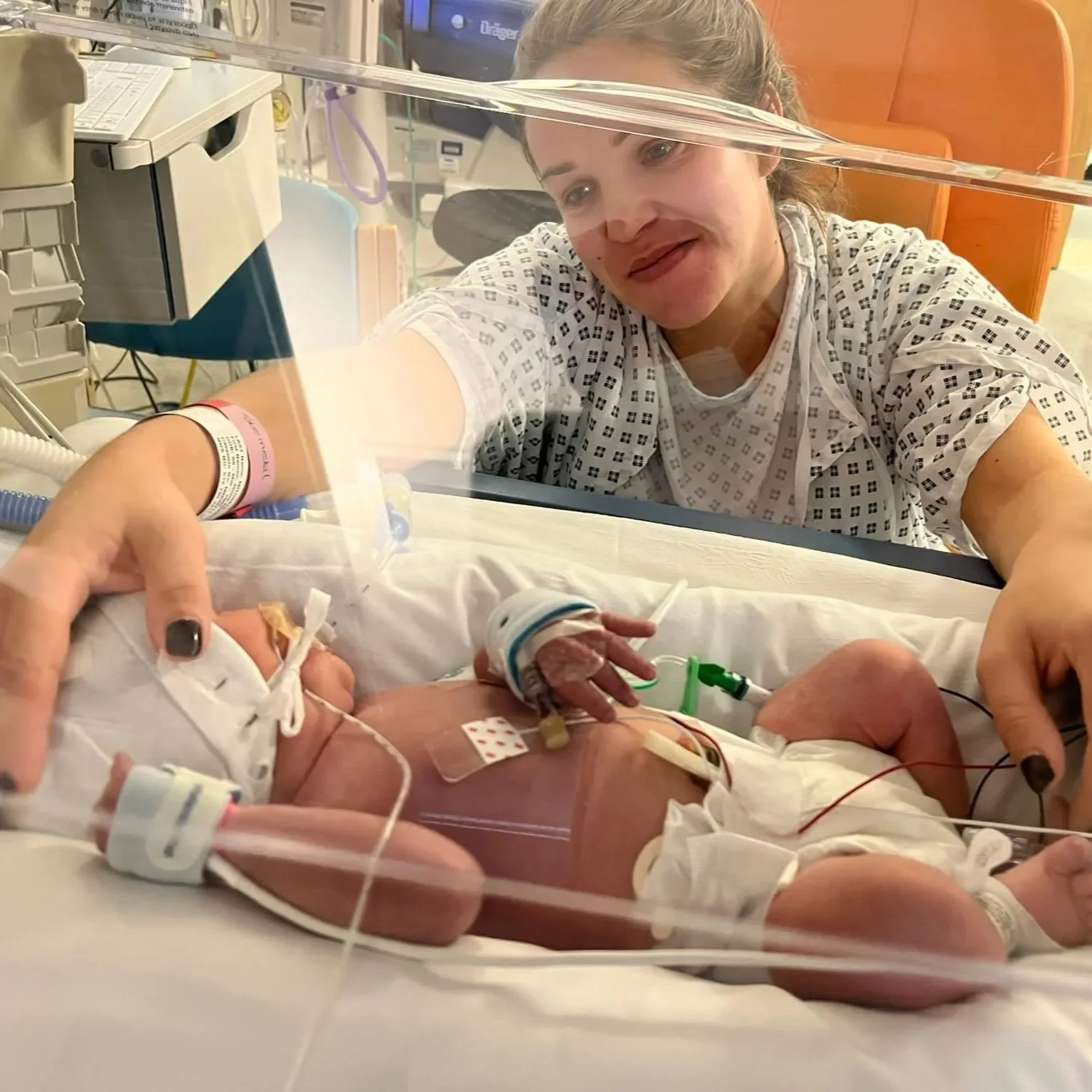 ‘This is NICU’ filmstar: Sebastian (35 weeks)