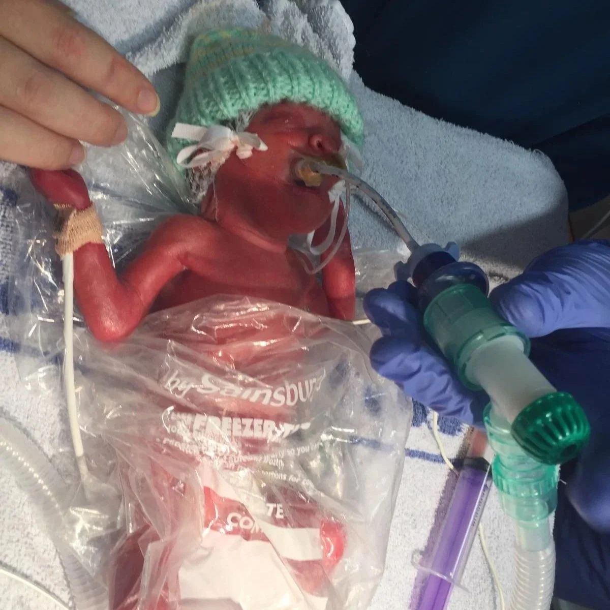 'This is NICU' filmstar: Tommy (26+6 weeks)