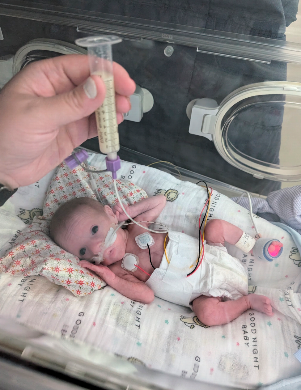 Feeding Tube Awareness Week 2026: Arlo's journey