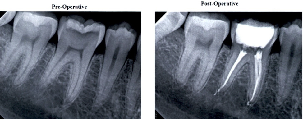 Lake Success Dentist | Dental Office in New Hyde Park | Garden City