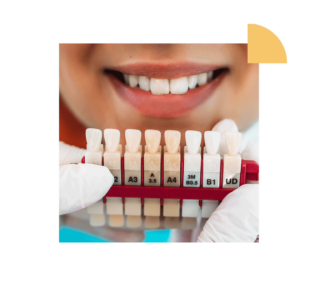 Best Dentist in Lake Success Long Island Implant Dentist in New Hyde