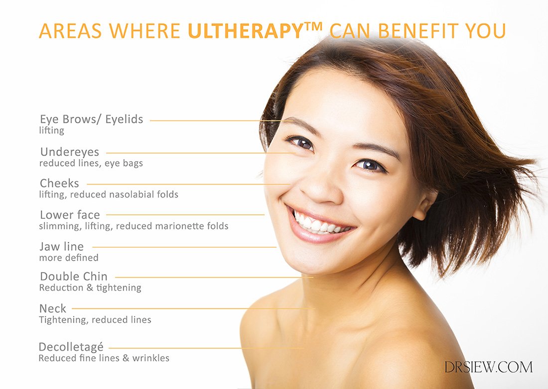 Areas-Ultherapy-Dr-Siew.jpeg