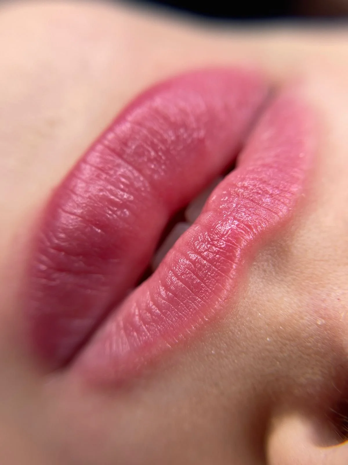 Após procedimento.jpeg