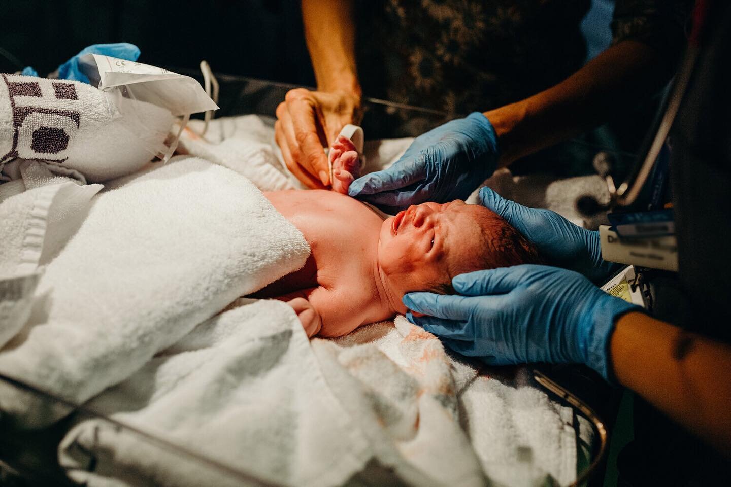 I saw this beautiful little bub on the beach with her parents the other day, and it was so lovely to see a healthy, happy 5 month old, especially when looking back at this little one who needed some extra help after she was born 🌝

It&rsquo;s incred