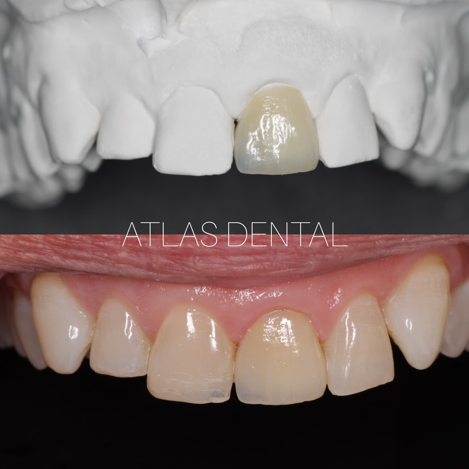 Dental | Downtown Crown Dentist, Toronto University-Dundas