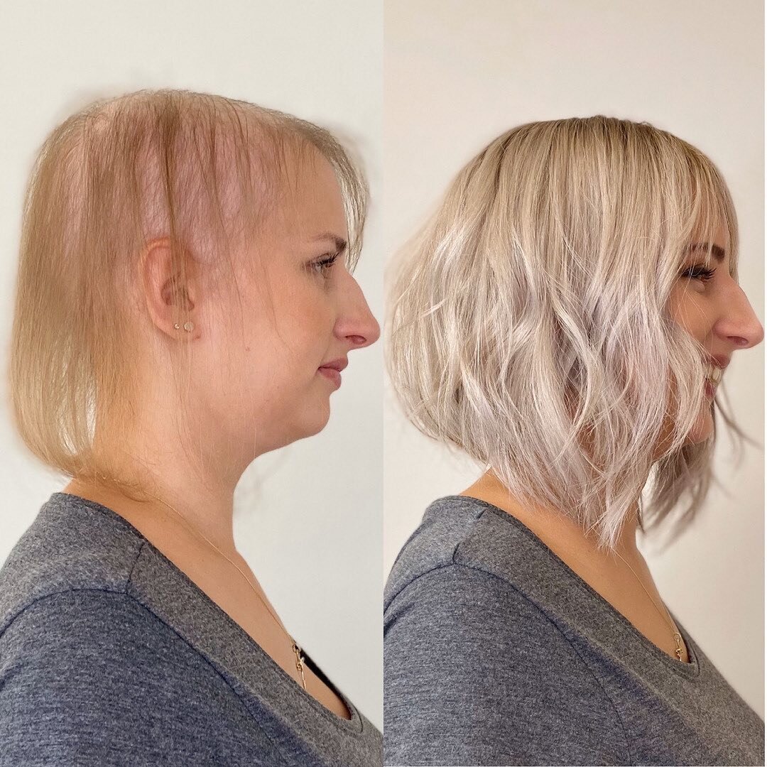 Put a smile back on your client's face with Hairdreams MicroLines. This breathable topper is the best non-surgical hair loss solution on the market today ✨
⠀⠀⠀⠀⠀⠀⠀⠀⠀
Stylists can click the link in our bio to learn more about MicroLines.
⠀⠀⠀⠀⠀⠀⠀⠀⠀
📸: