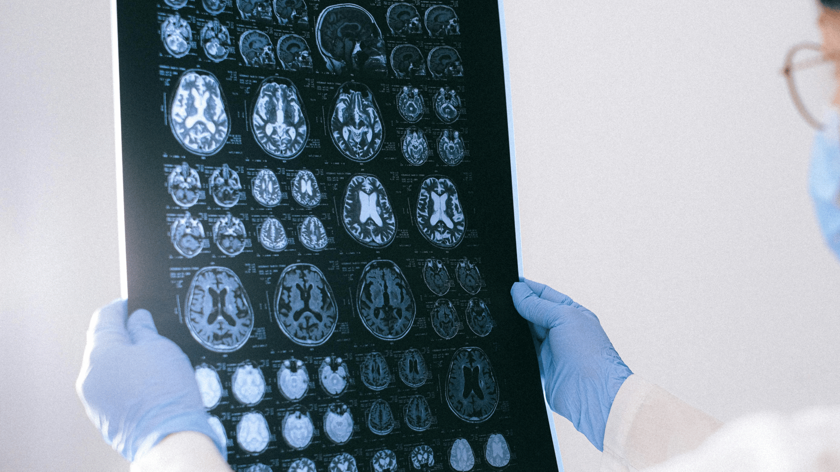 Hidden Brain Injuries — When Symptoms Show Up Months or Years Later