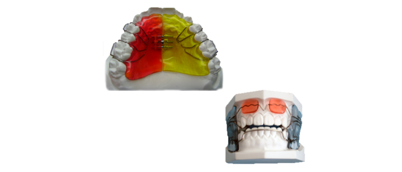 Orthodontics — GCDL