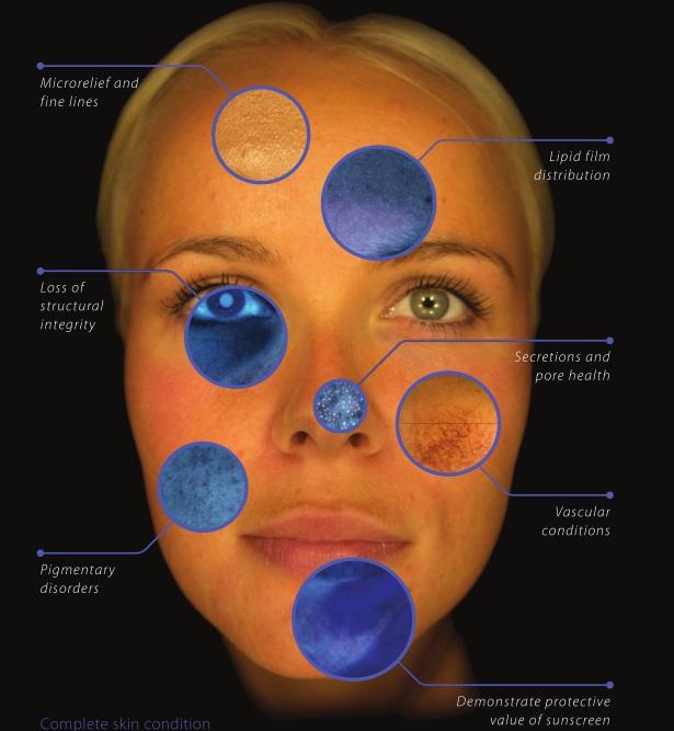 SISU digital skin analysis image