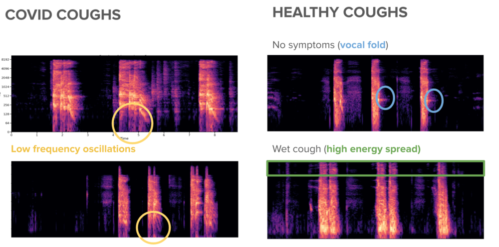 Detecting COVID-19 Through Sound
