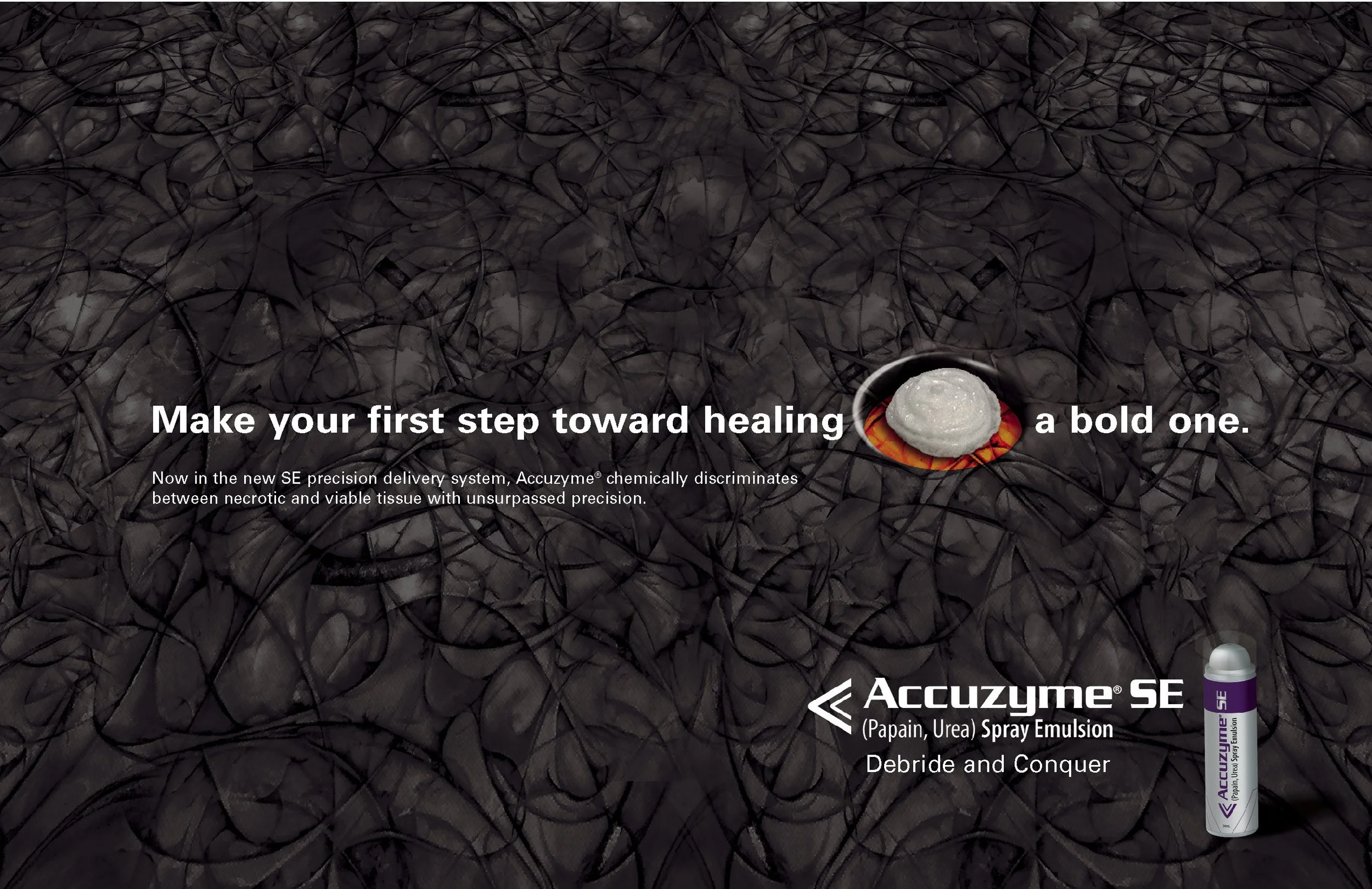 Accuzyme