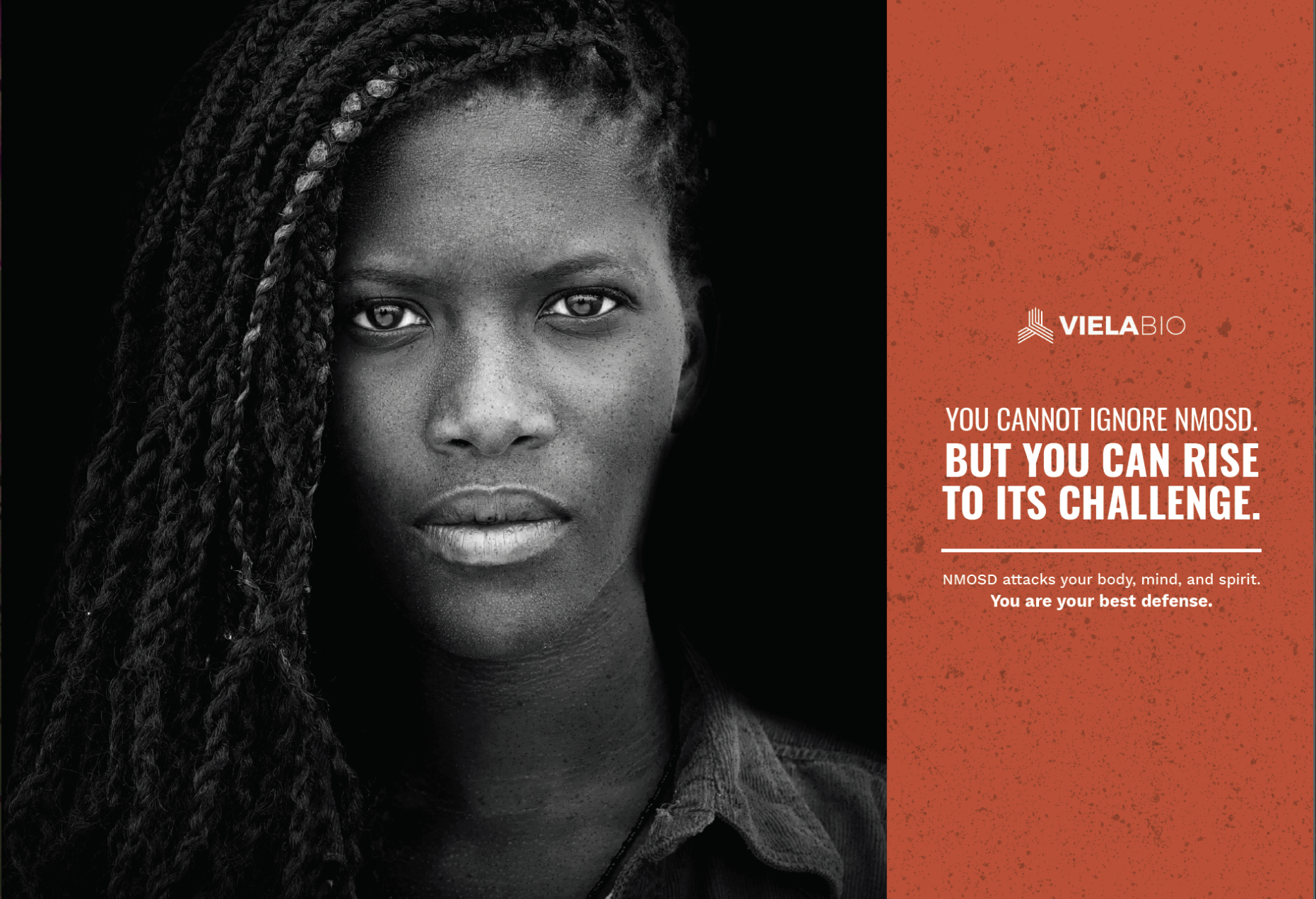 NMOSD (Neuromyelitis Optica) 