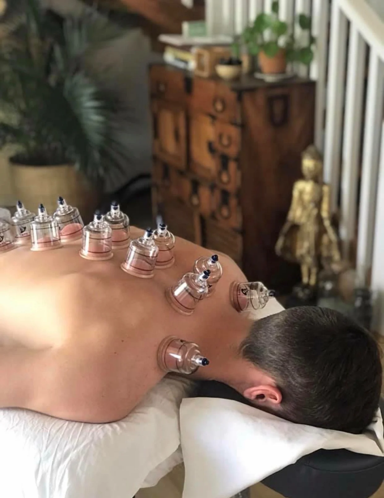 Have you heard of Myofascial Cupping?