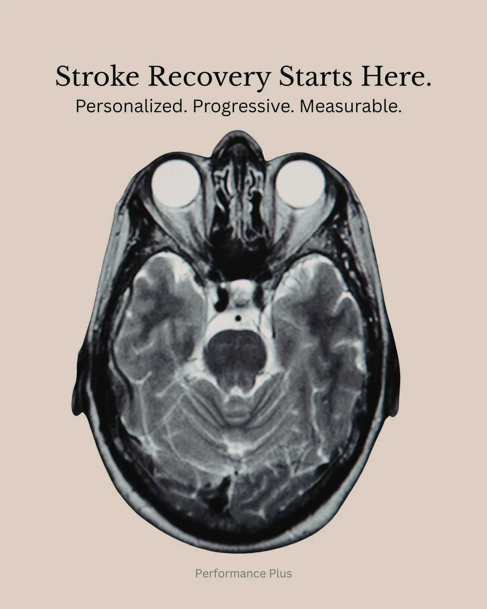 Stroke recovery isn&rsquo;t one-size-fits-all&mdash;and it shouldn&rsquo;t be treated that way.

At Performance Plus, rehabilitation is built around neurological findings, objective performance measures, and your specific stage of recovery.

Our appr