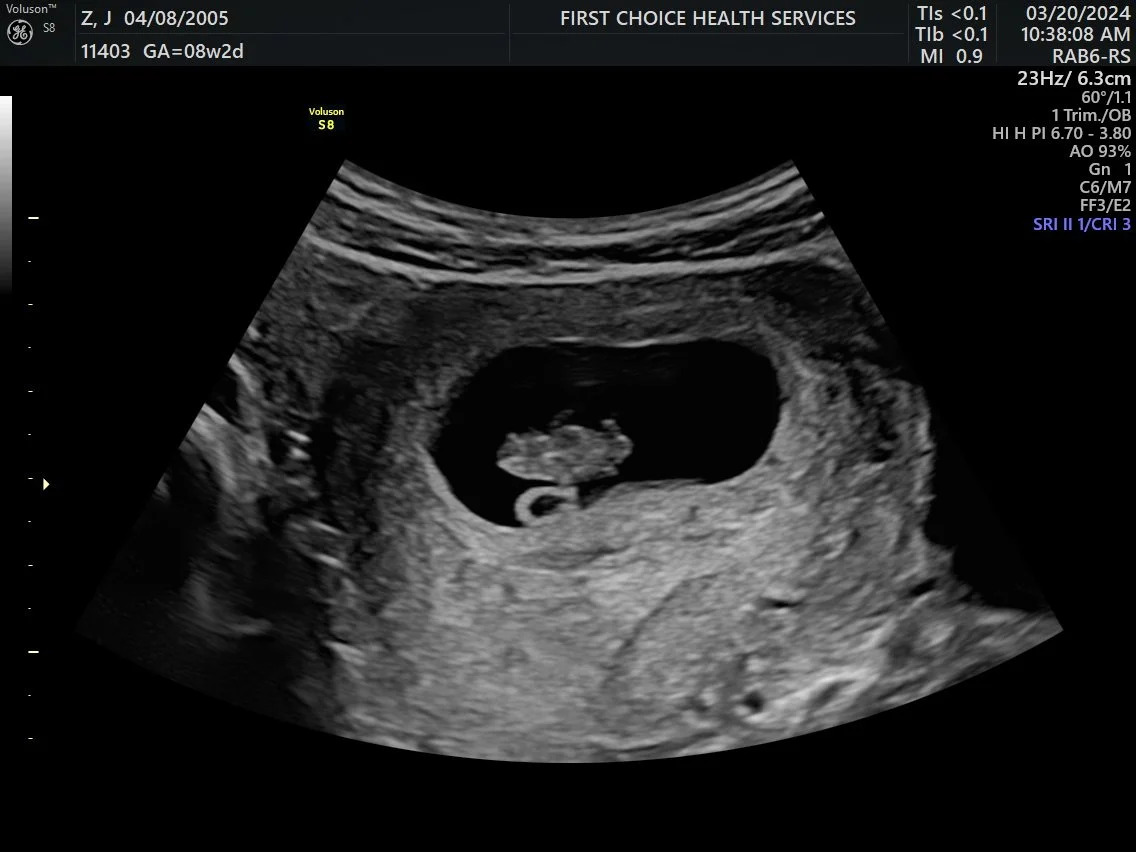 Why an Ultrasound Can Change Everything
