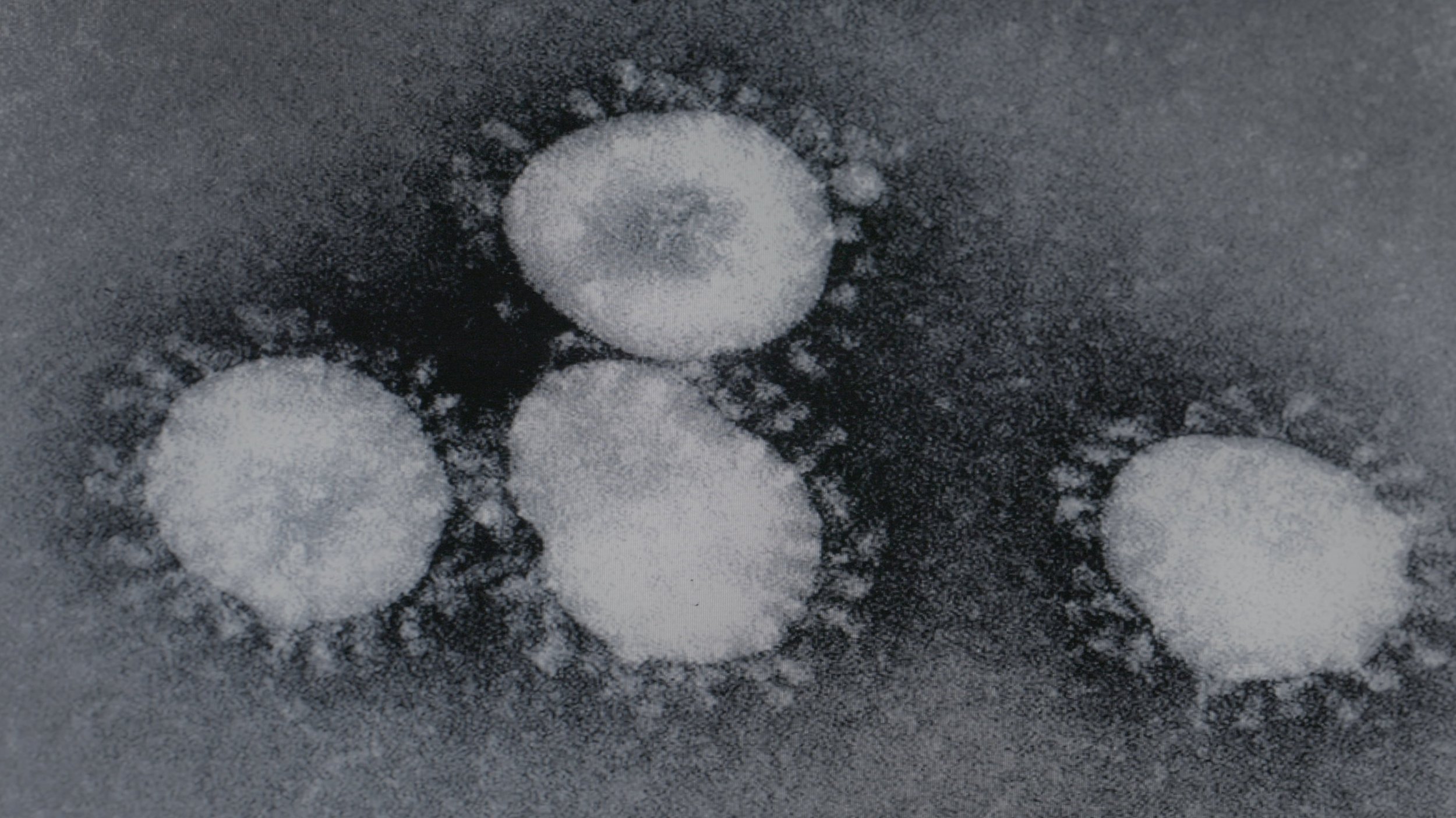 VHD_Promo STILL_6_The Coronavirus-min.jpg