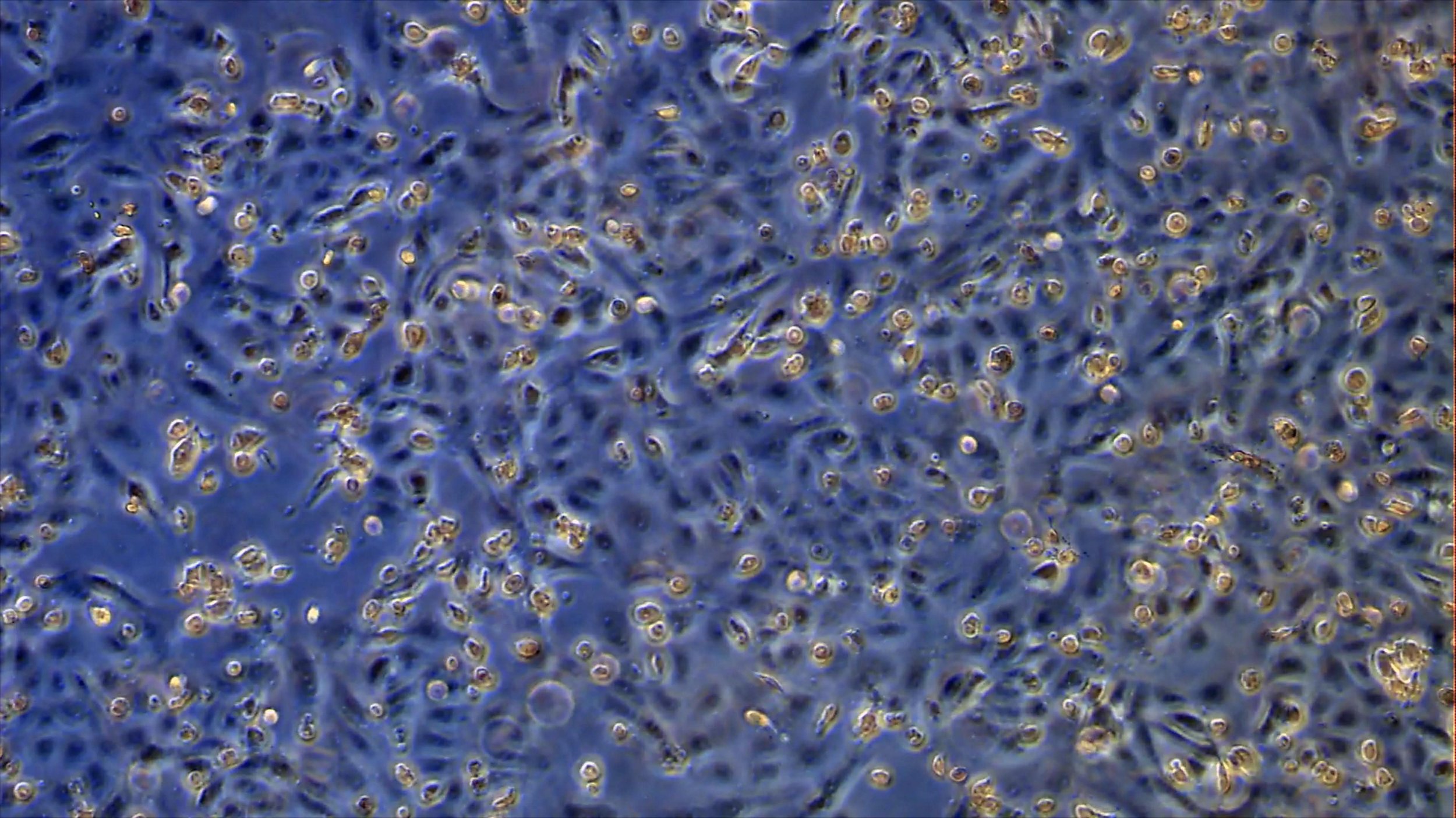 VHD_Promo STILL_25_Cells Infected with COVID19-min.jpg