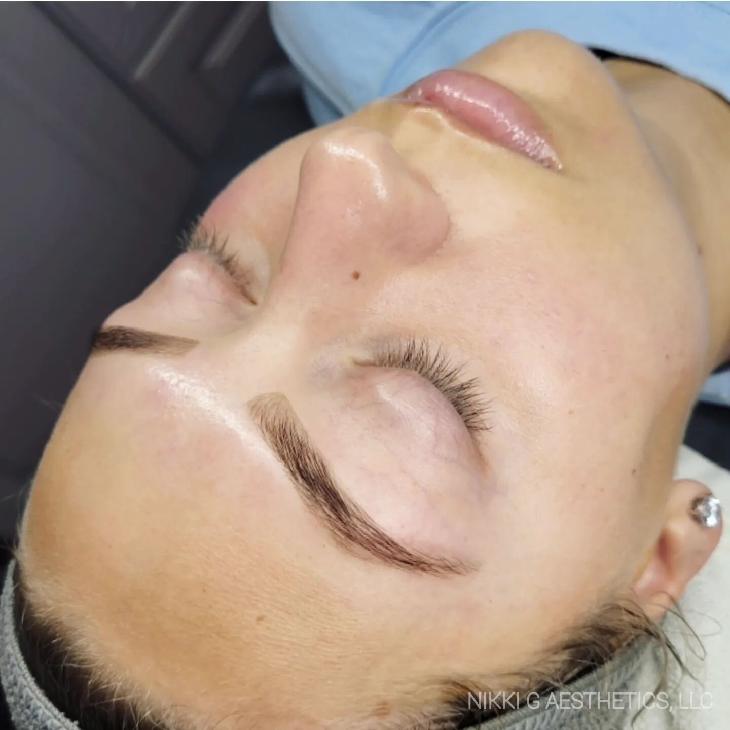 𝐍𝐀𝐍𝐎-𝐈𝐍𝐅𝐔𝐒𝐈𝐎𝐍 &amp; 𝐁𝐑𝐎𝐖 glow-up for the win🤩
.
.
.
.
.
.
.
.
.
.
#nikkigaesthetics #nanoneedling #nanoinfusion #osmosisskincare #skininfusion #glowup #glowingskin #skinperfect #estheticianlifestyle #estheticslife #Esthetician #esthe