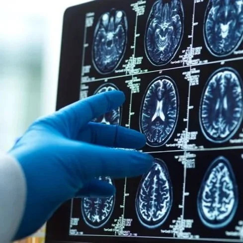 glp-1 for alzheimer's prevention