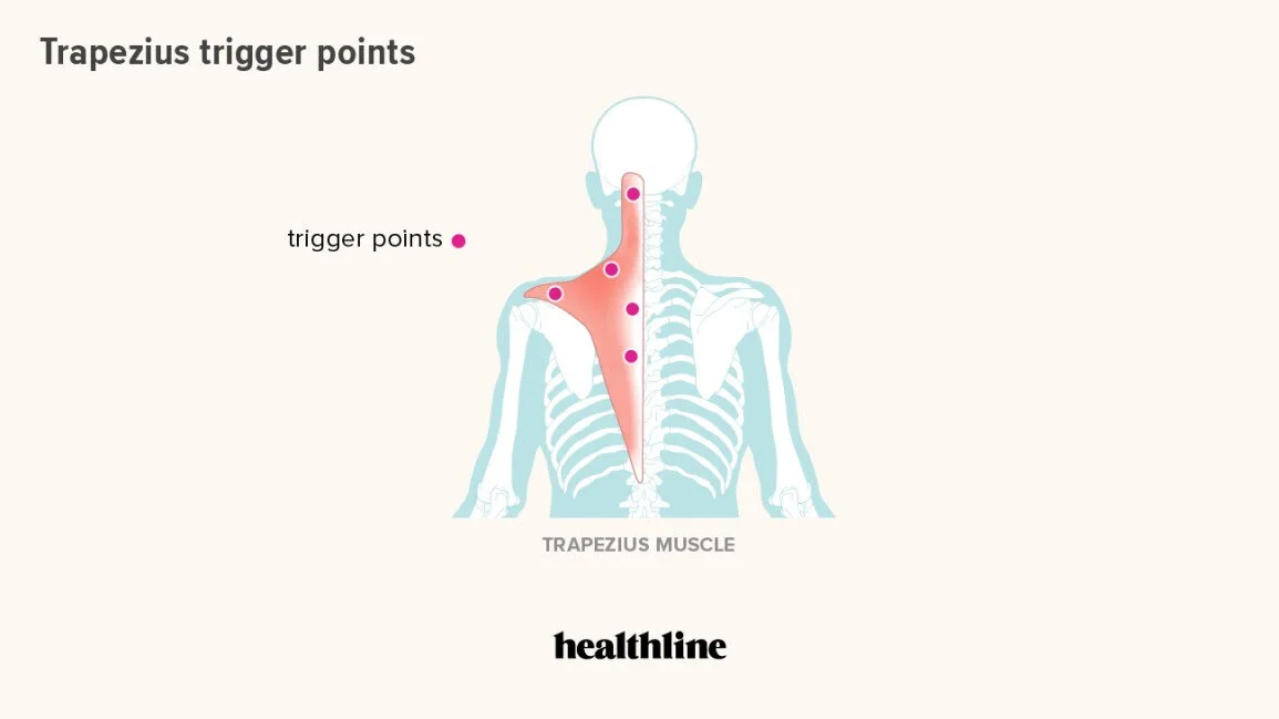 TRIGGER POINTS