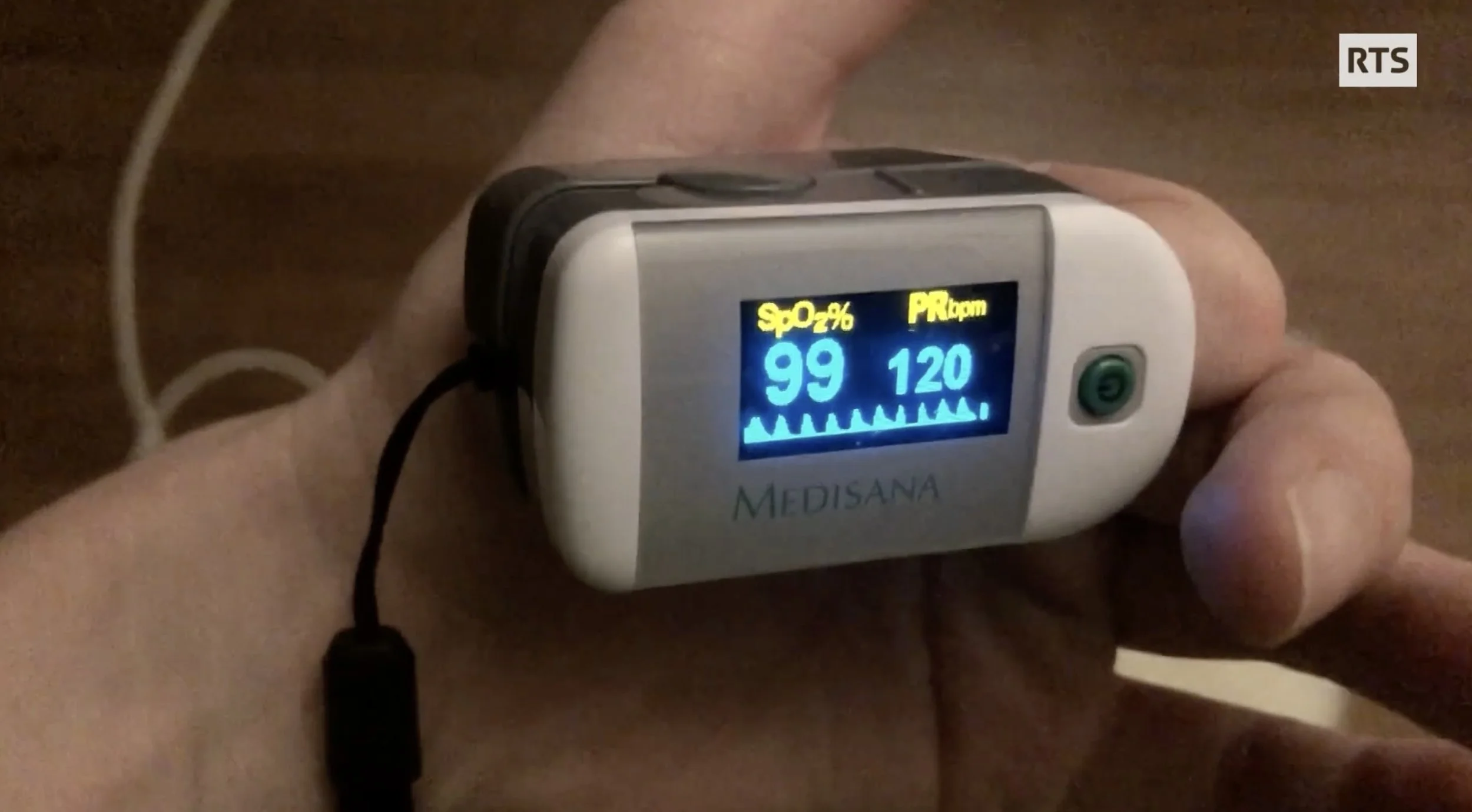 RTS: Covid long et encéphalomyélite myalgique