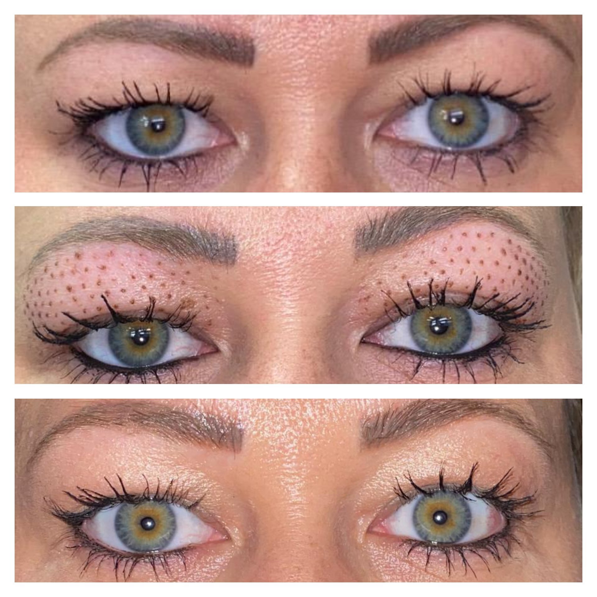 Add to Before and After Gallery in Face - 9.jpg