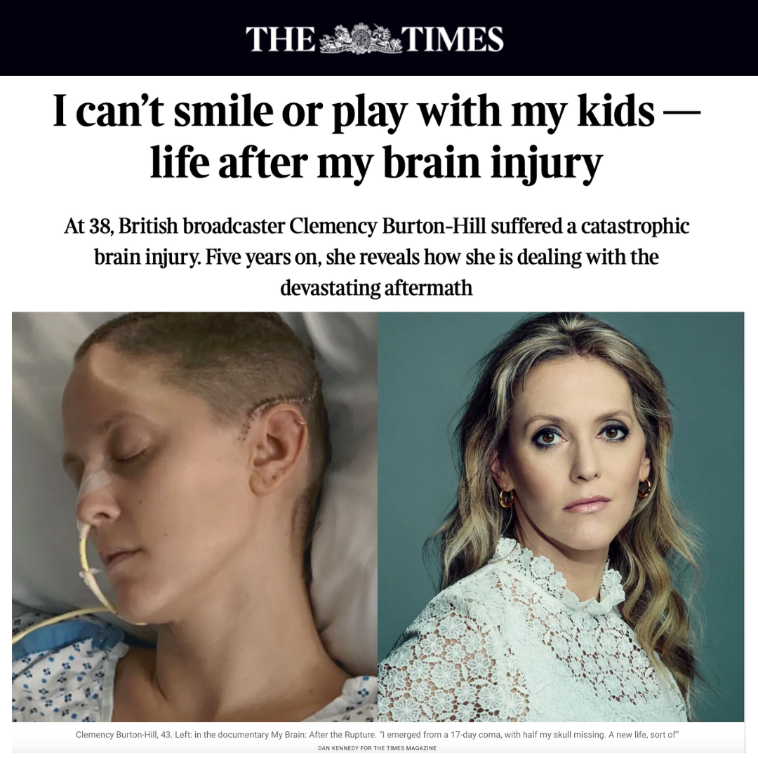“I can’t smile or play with my kids — life after my brain injury” - The Times
