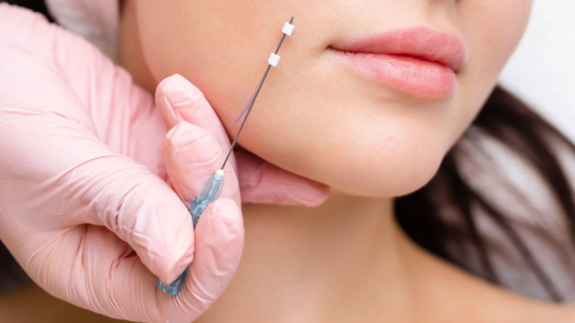 The Thread Lift Procedure at Premier Medical Aesthetics