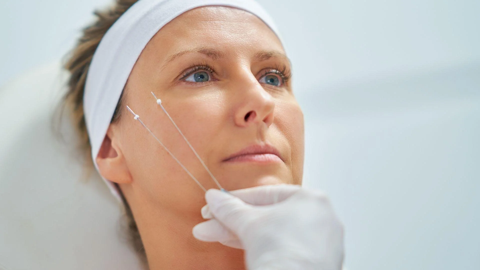 Thread Lift for Jowls in Chattanooga: Tighten Sagging Skin Fast