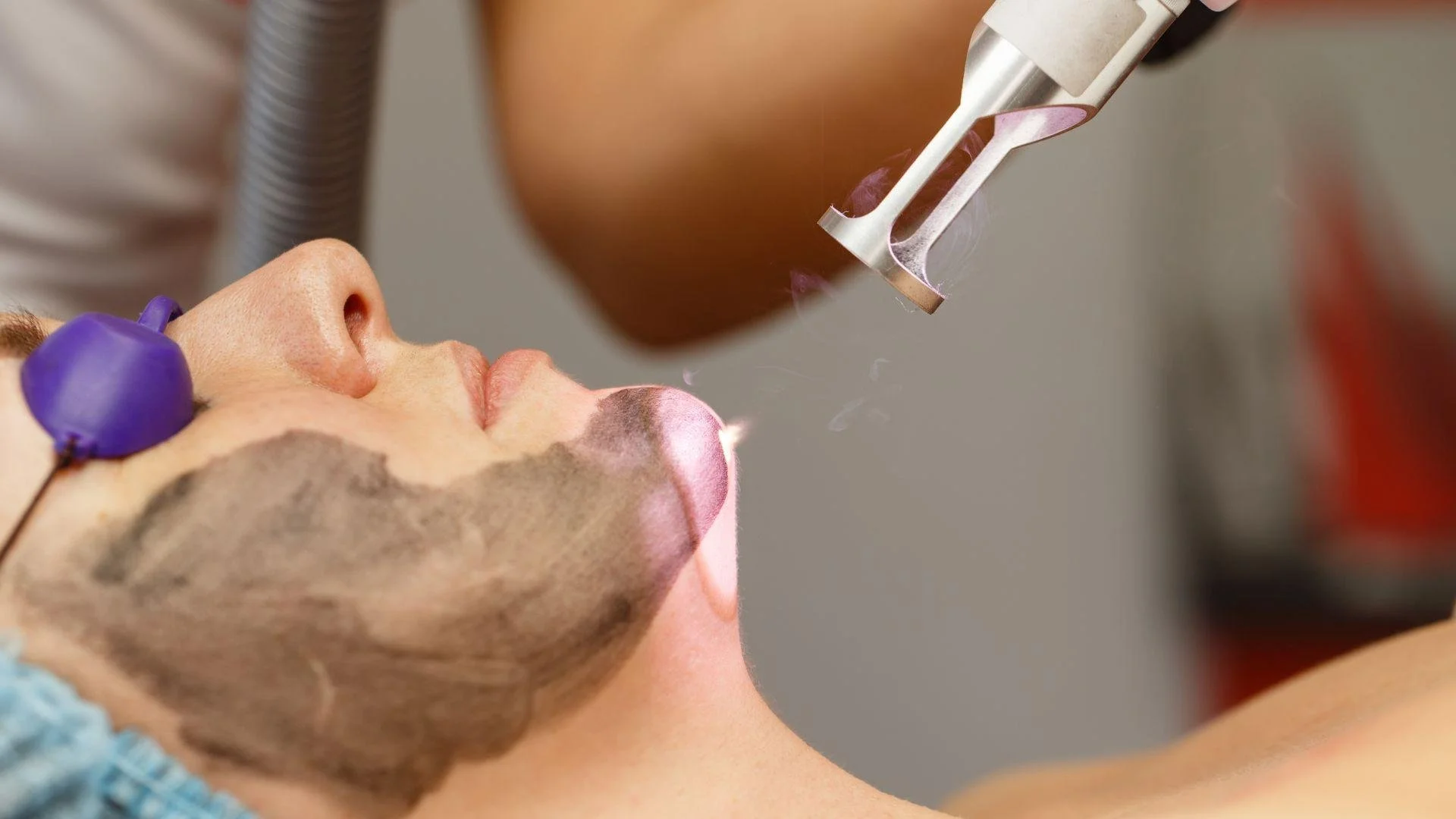 Energy-Based Collagen Stimulation Treatments