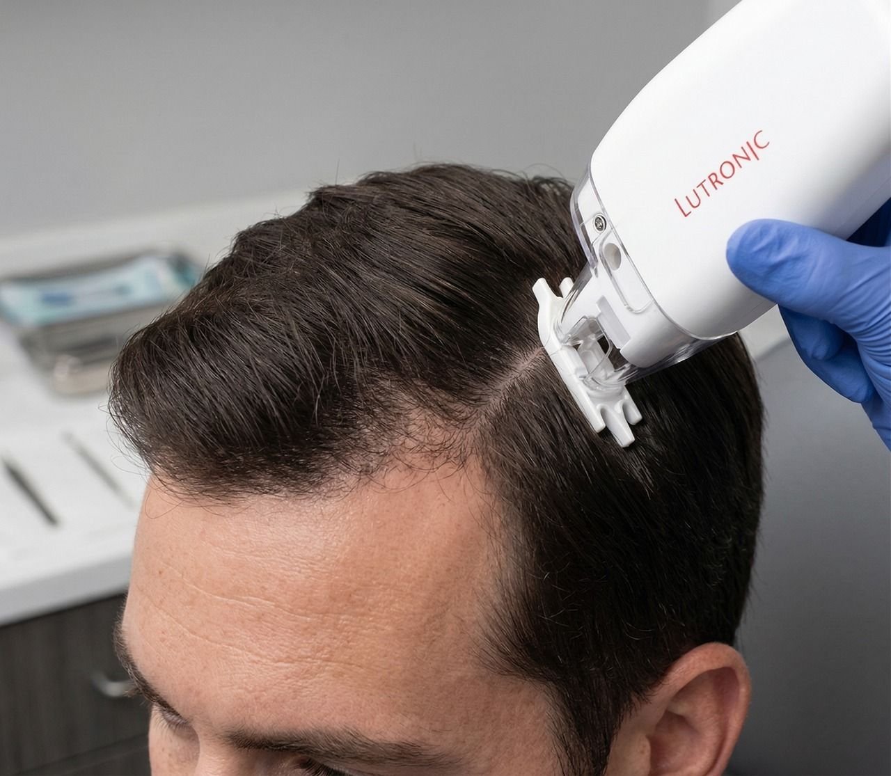 KeraLase Hair Restoration: A Modern Solution