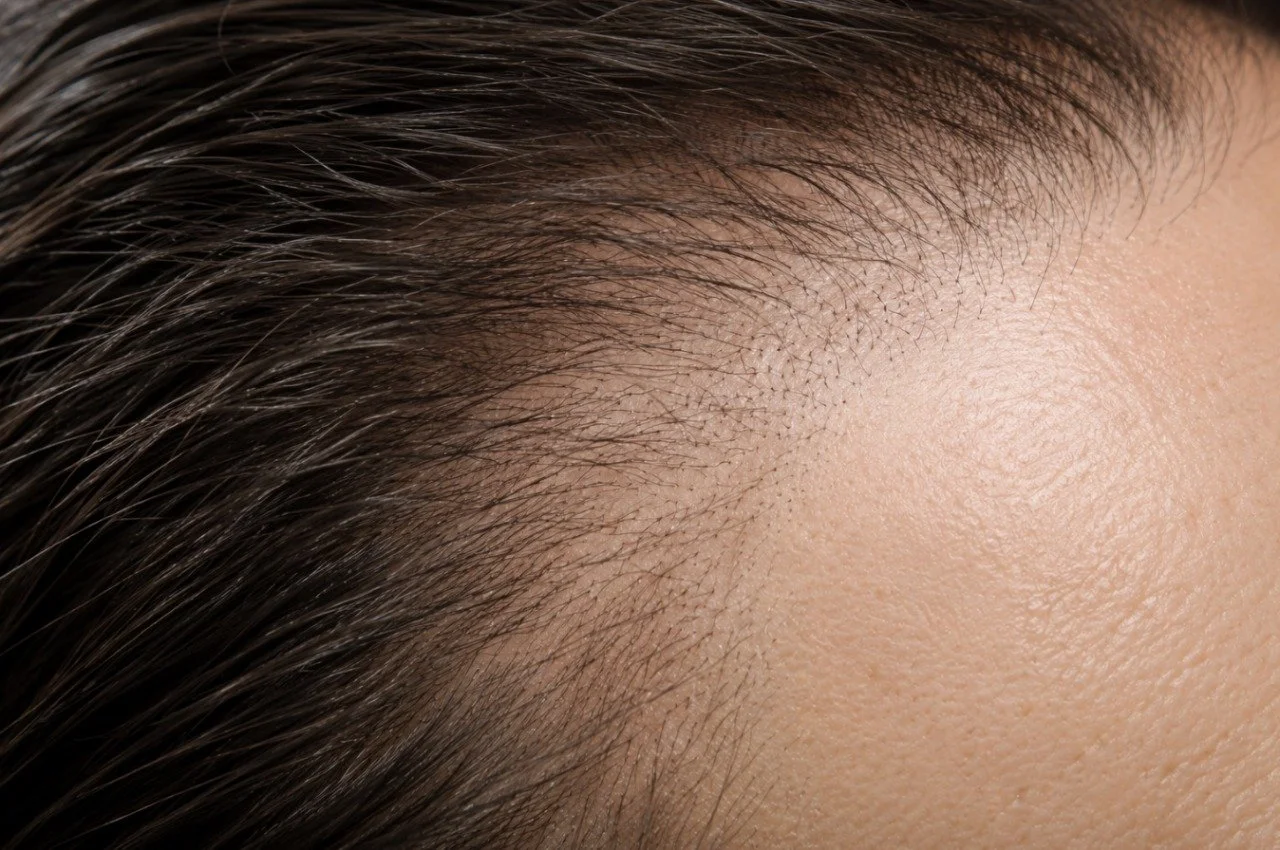 Can Hair Grow Back After Thinning