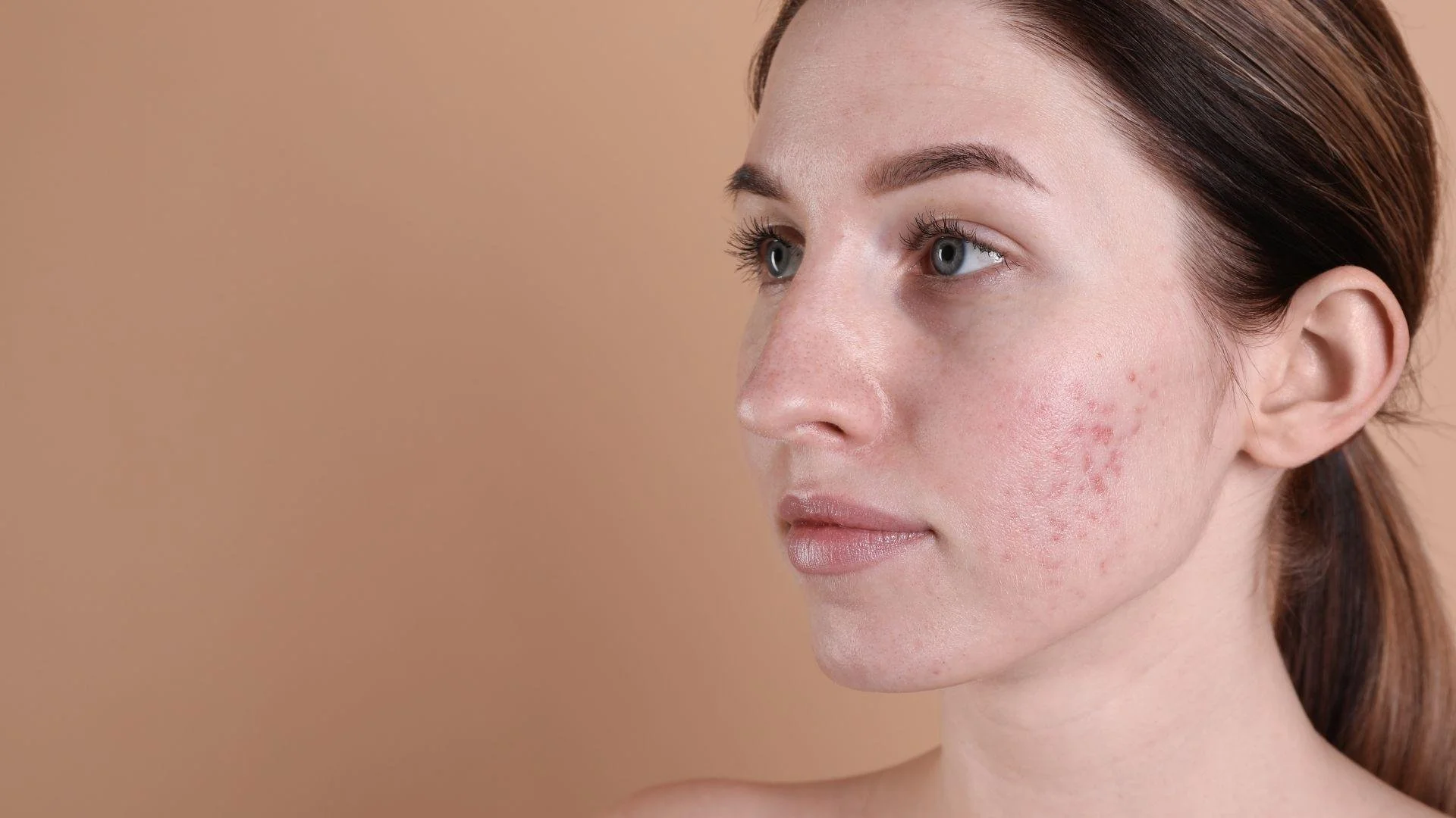 Why Skin Loses Its Glow Over Time