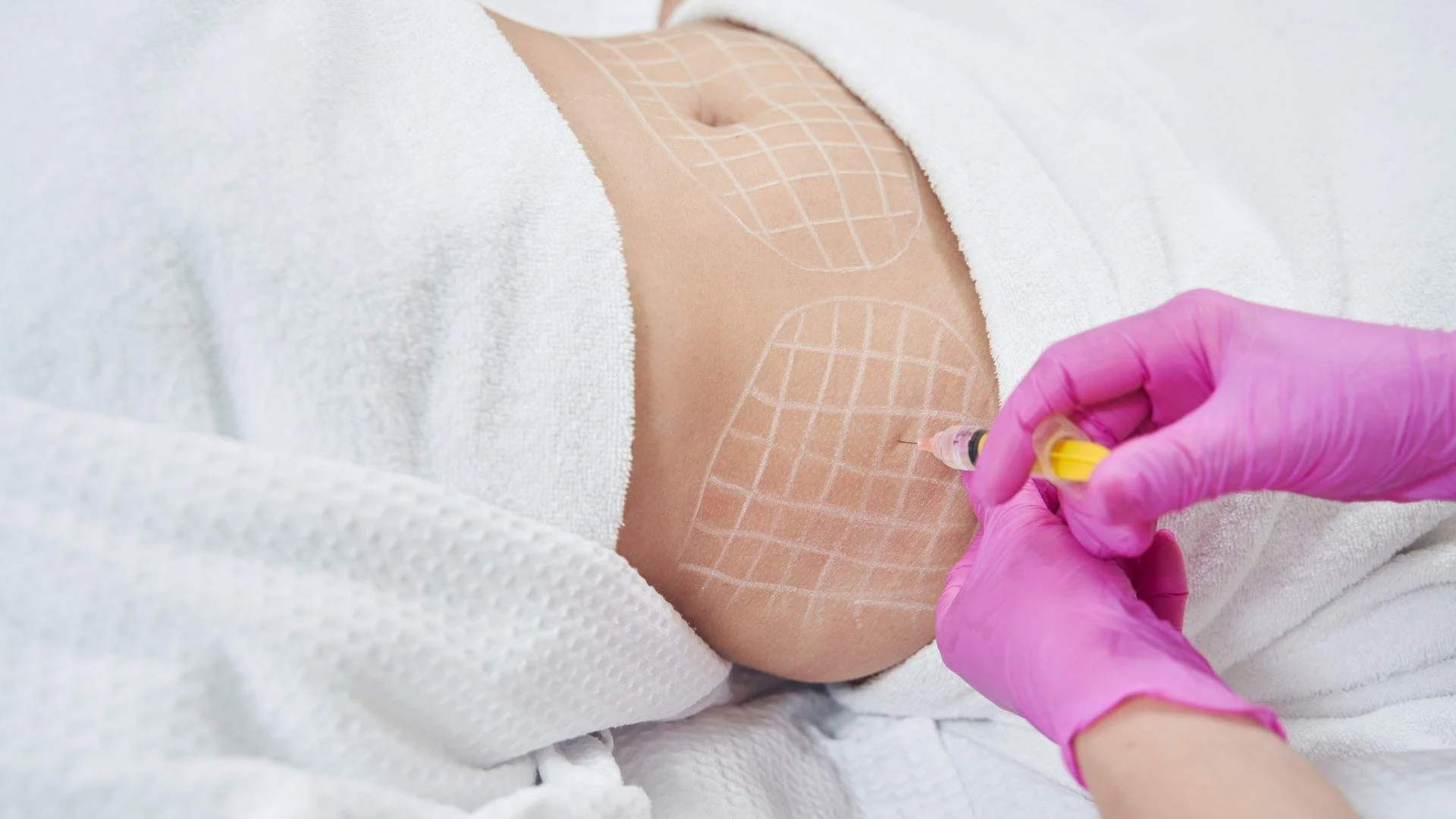 Fat Dissolving Injections in Chattanooga