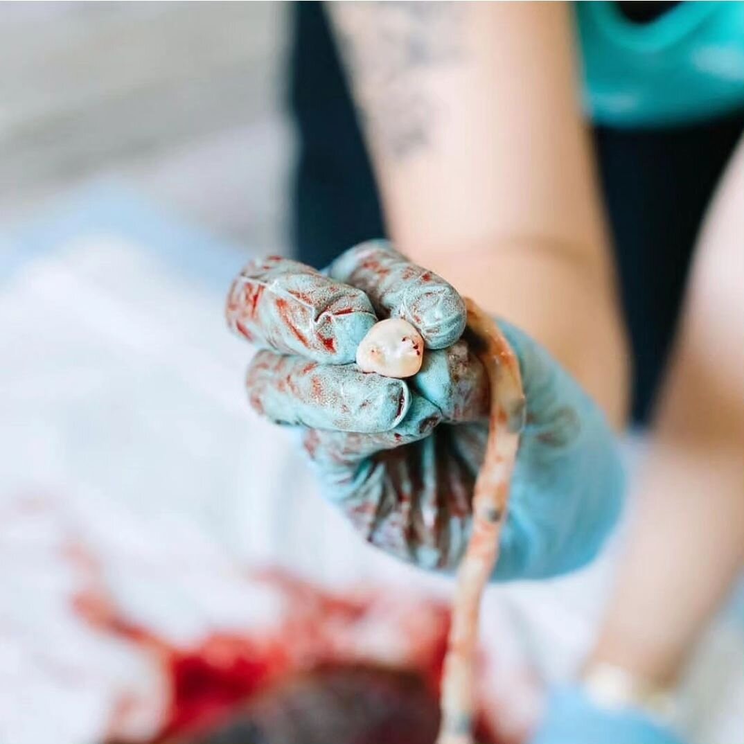 What's in a cord?

Most umbilical cords are made up of three vessels -  two arteries and a vein.

Super quick doula hack....remember the name AVA. ie. artery, vein, artery
.
.
.
@darianclousephoto
.
.
Preparing for Birth is modern childbirth curricul