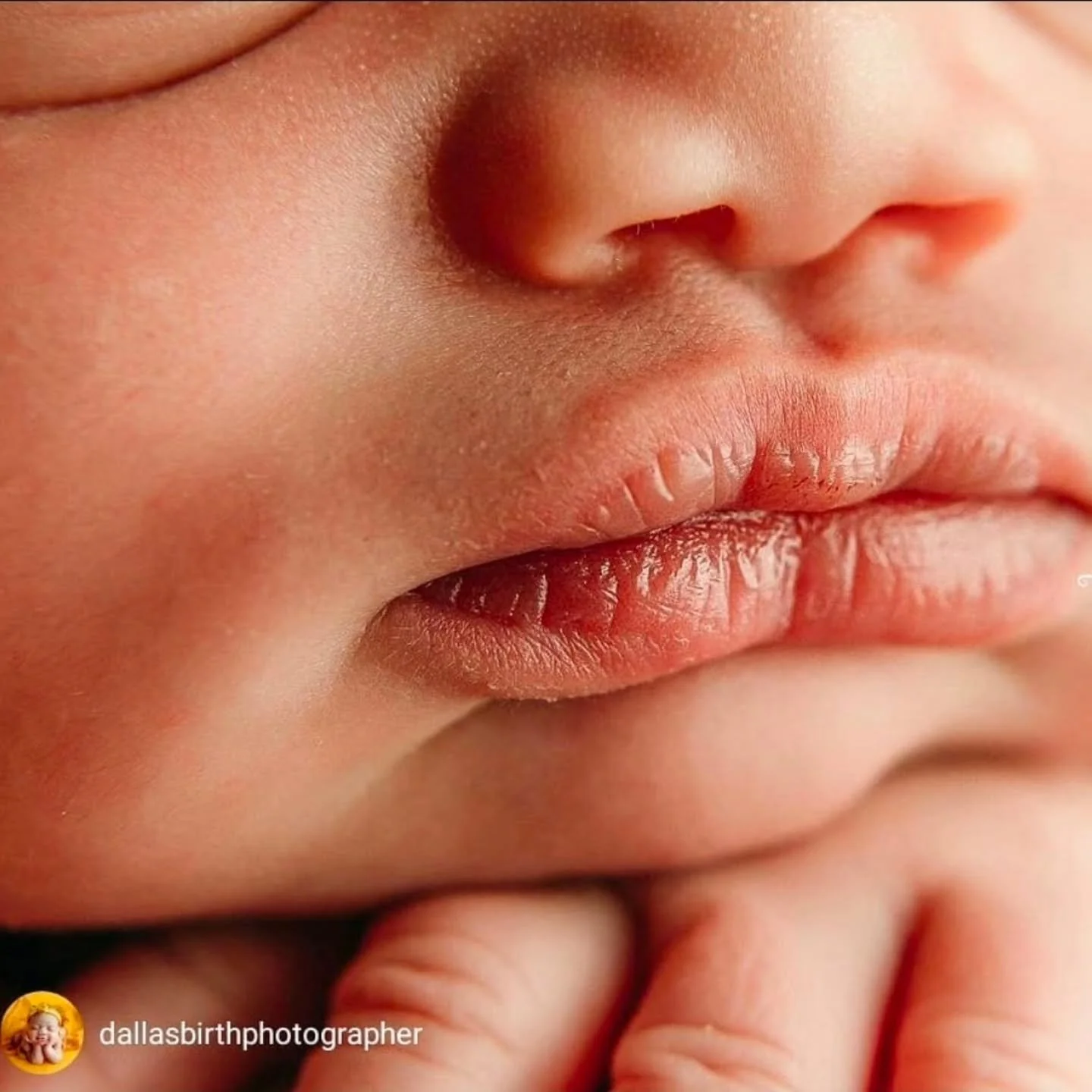 Your baby's face.

It's beautiful - obviously! However, a newborn's face may look puffy due to fluid accumulation and due to their experience while you pushed. 

Your baby's face will change as the fluid recedes and times passes healing the effects o
