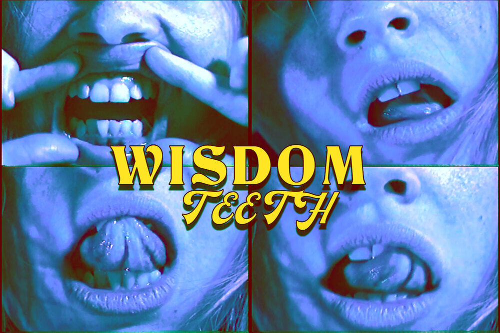 Wisdom+Teeth.jpg