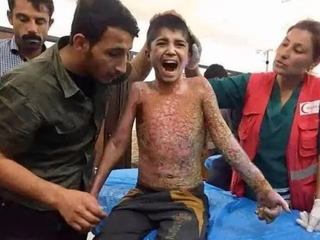 Concrete evidence of Turkey&rsquo;s use of chemical weapons against civilian populations in Rojava have been found by the Wessling Laboratory in Switzerland. 
The Autonomous Administration of Rojava confirmed that Turkey targeted more than 30 unarmed