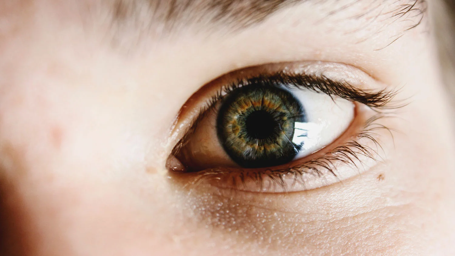 What it's like to get Lasik eye surgery
