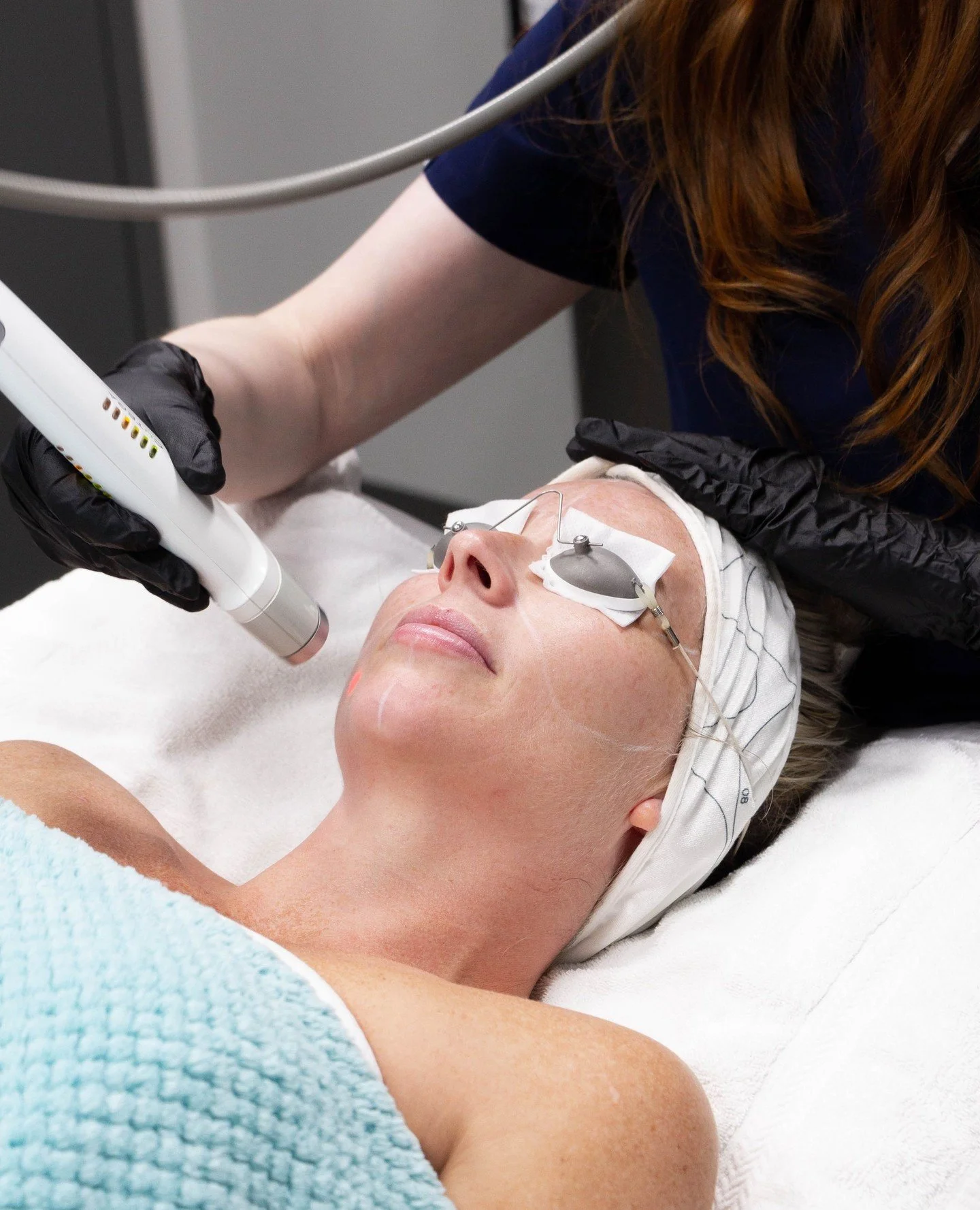 It&rsquo;s officially laser season 🔥⁠
⁠
Now&rsquo;s the time to target sun damage, redness, pigmentation, and uneven texture with our Laser Treatment Packages.⁠
⁠
✨ Brighten &amp; Restore: 3 full-face pigment treatments + Vivier Brighten &amp; Resto