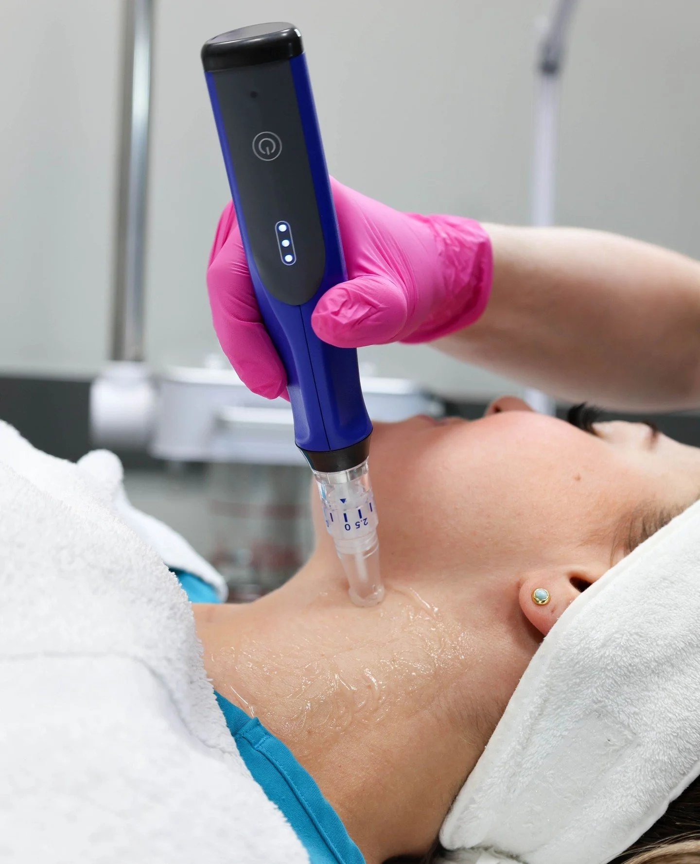 Microneedling is basically a total "reset" button for your face. We love it because it&rsquo;s a natural way to:⁠
⁠
✨ Smooth out rough texture⁠
⁠
🩹 Fade the look of old acne scars⁠
⁠
🧬 Firm things up by boosting your own collagen⁠
⁠
It&rs
