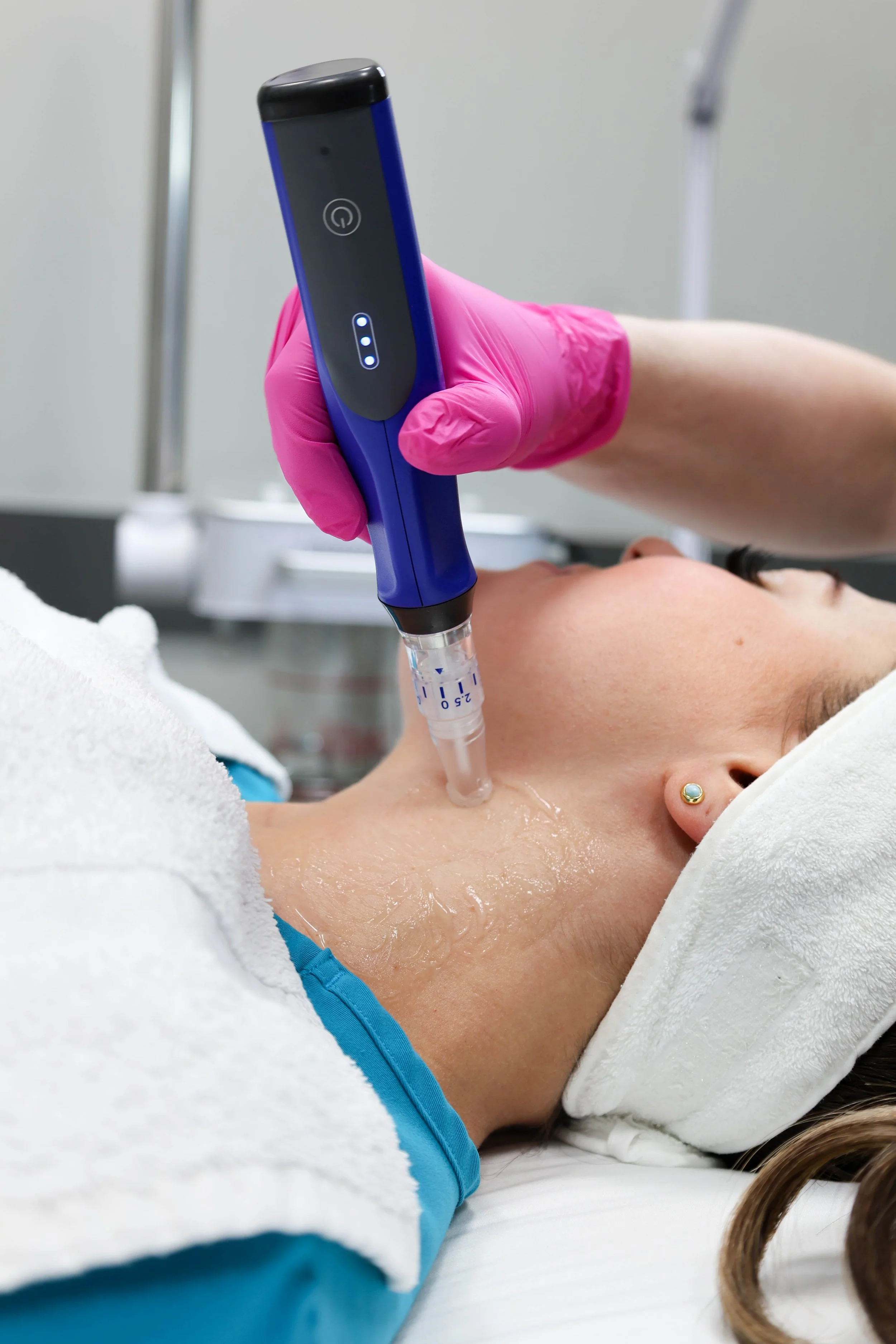 Microneedling at Cosmetic Medical Clinic